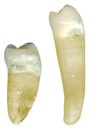 Macrodont Md 2nd Premolar.jpg